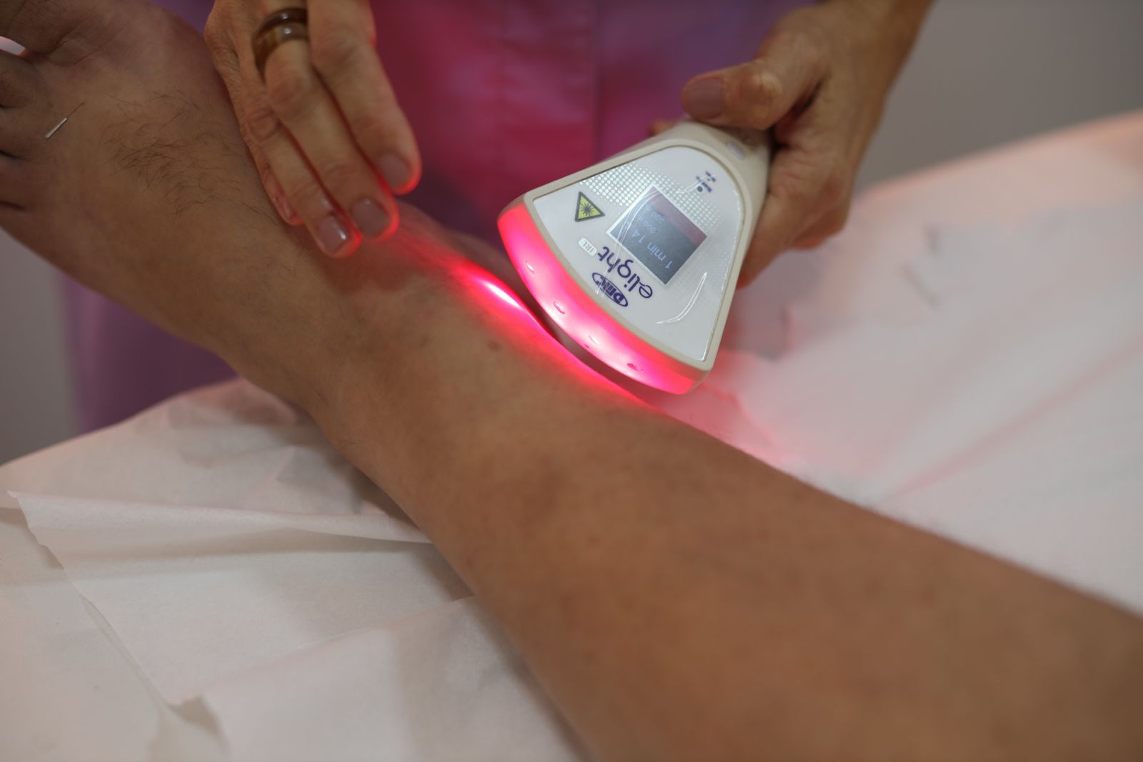 Laserterapia